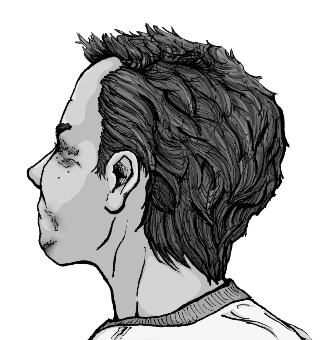 ilustração em preto e branco da cabeça de um homem de perfil, quase de costas, deixando ver um pedaço de machucado em volta do olho e da boca.